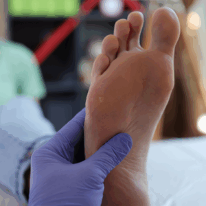 tratamiento para fascitis